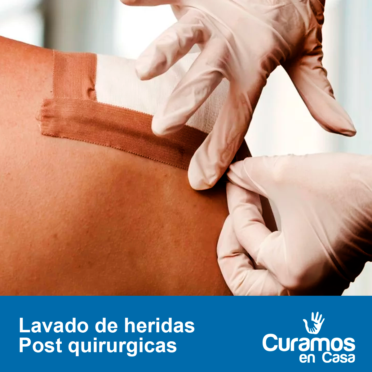 Curación avanzada de heridas